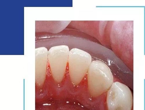 The Best At-Home Teeth Cleaning Products